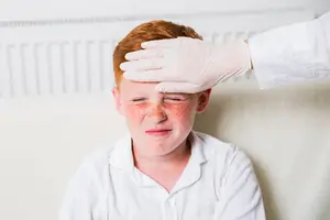 ما هي أعراض الجدري المائي عند الأطفال؟